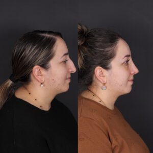 yeni-3-10-300x300
