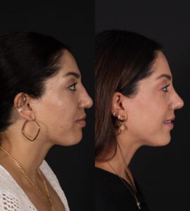 yeni-3-11-270x300
