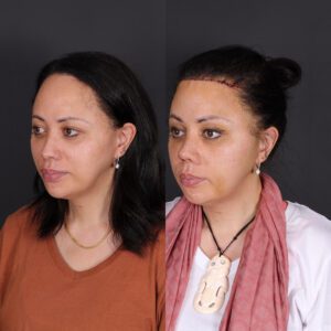 yeni-3-12-300x300