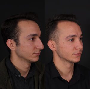 yeni-3-2-302x300