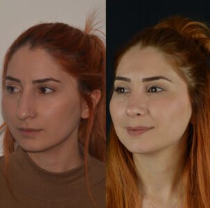 yeni-3-3-303x300