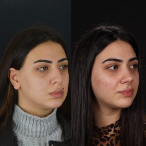 yeni-3-7-300x300
