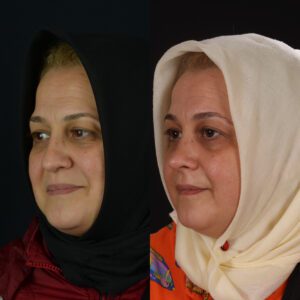 yeni-3-9-300x300