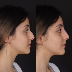 yeni-300x300