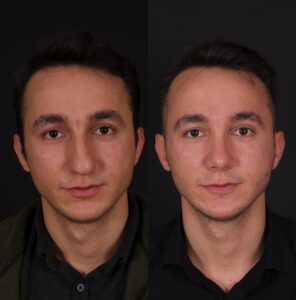 yeni-4-2-296x300