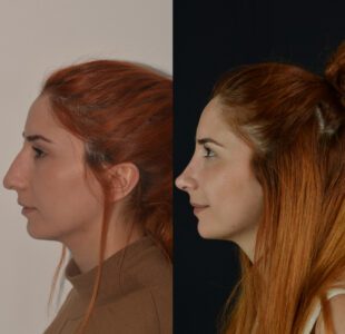yeni-4-3-310x300