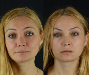 yeni-4-355x300
