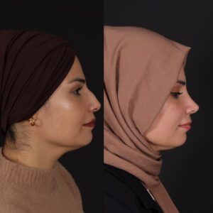 yeni-4-5-300x300