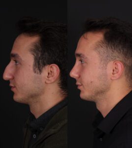yeni-5-1-269x300