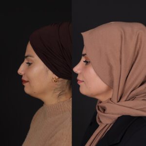 yeni-5-3-300x300