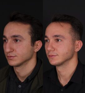 yeni2-1-273x300