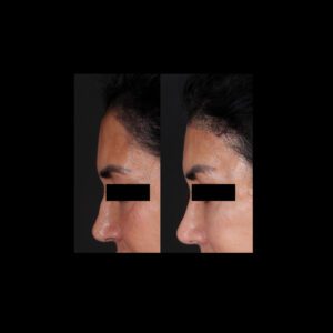 yeniiii-300x300