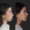 #1 (5) Facial Implants, 22 y.o., 8 days
