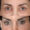 #4 Up. Eyelid, 58 y.o., 2 months
