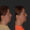 #6 Facial Implants, 42 y.o., 1 month
