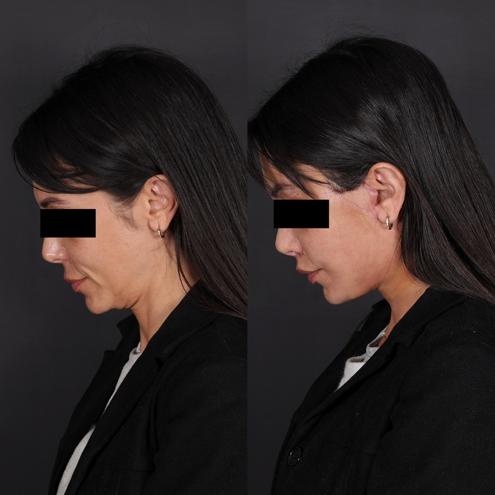 caroline-11-1000x1000