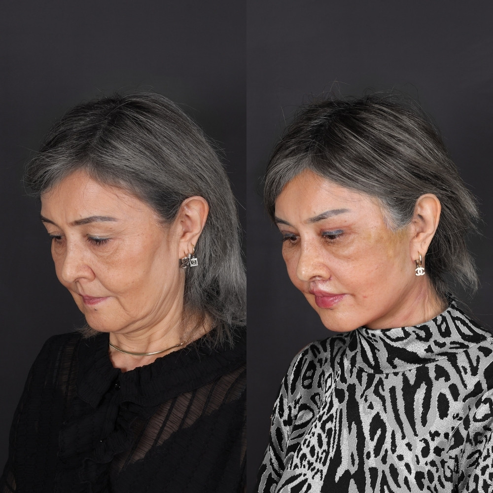 feride1