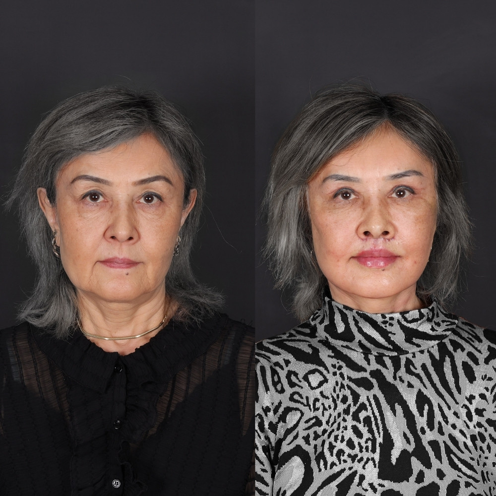 feride4